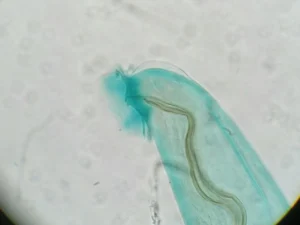 Rat lungworm parasite