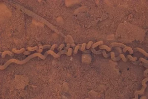 Toad eggs coiled up